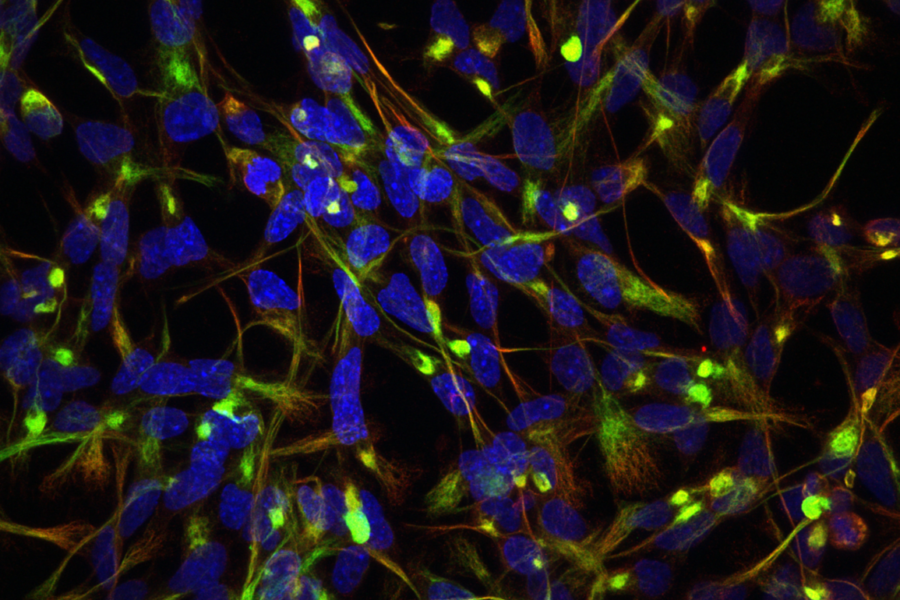 fluorescent labeling of neurons