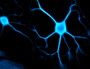 temporary photo of a neuron